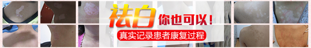 康复案例